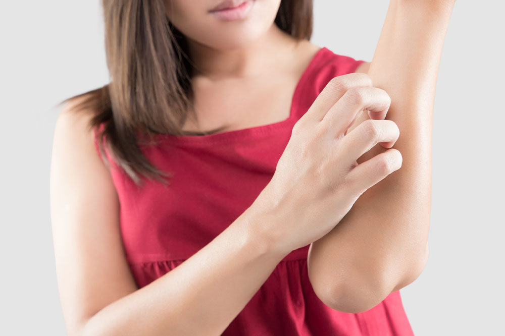 Managing dermatitis &#8211; 11 remedies for itchy skin