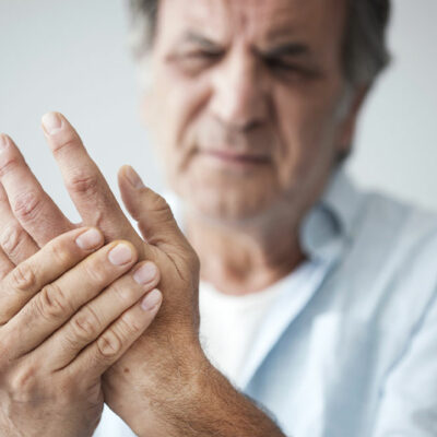 Everything to Know About Rheumatoid Arthritis