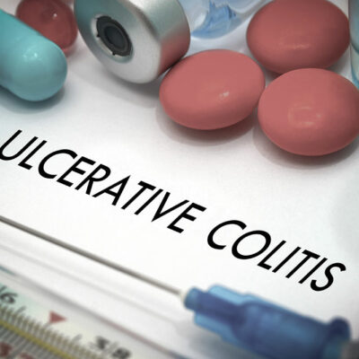 5 Foods That Help Manage Ulcerative Colitis and Crohn&#8217;s Disease