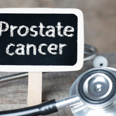 Causes, Symptoms, and Ways to Manage Prostate Cancer